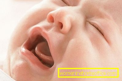 Plavi nasolabijalni trougao kod novorođenčadi: uzroci